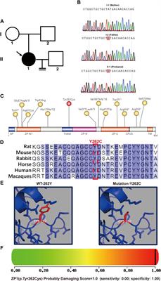 ZP1-Y262C mutation causes abnormal zona pellucida formation and female infertility in humans